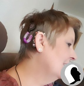 CI Kopf 2018 Erwachsen